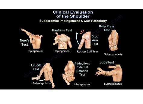 shoulder pain tests for men